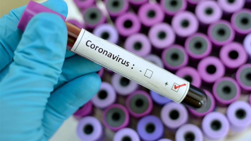 URGE CAMPAÑA INFORMATIVA SOBRE CORONAVIRUS: PAN CDMX